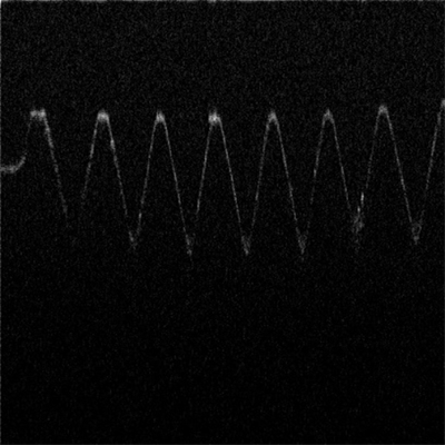 OCT视觉-6.jpg